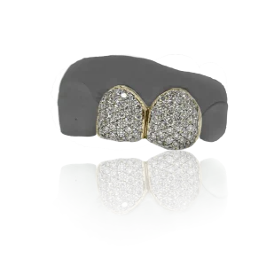Twin Tooth Iced Out Solid 14ct Gold Grillz
