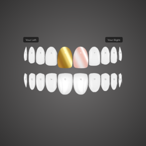 Custom Grill: KG-0W2RZSQBPS