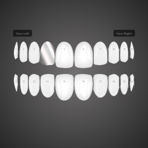 Custom Grill: KG-1PA4UV4PBW