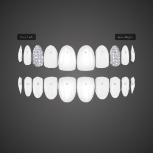 Custom Grill: KG-CY4PKN2QX0