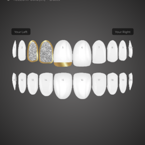 Custom Grill: KG-UYFPIKRJQK