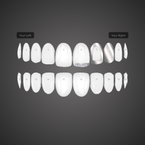 Custom Grill: KG-XWKCZ11ER6