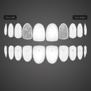 Custom Grill: KG-9Q8B5C4IBJ